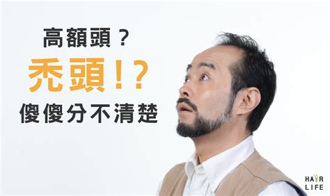 額頭高定義|【解惑】高額頭？禿頭？！到底該如何區分 